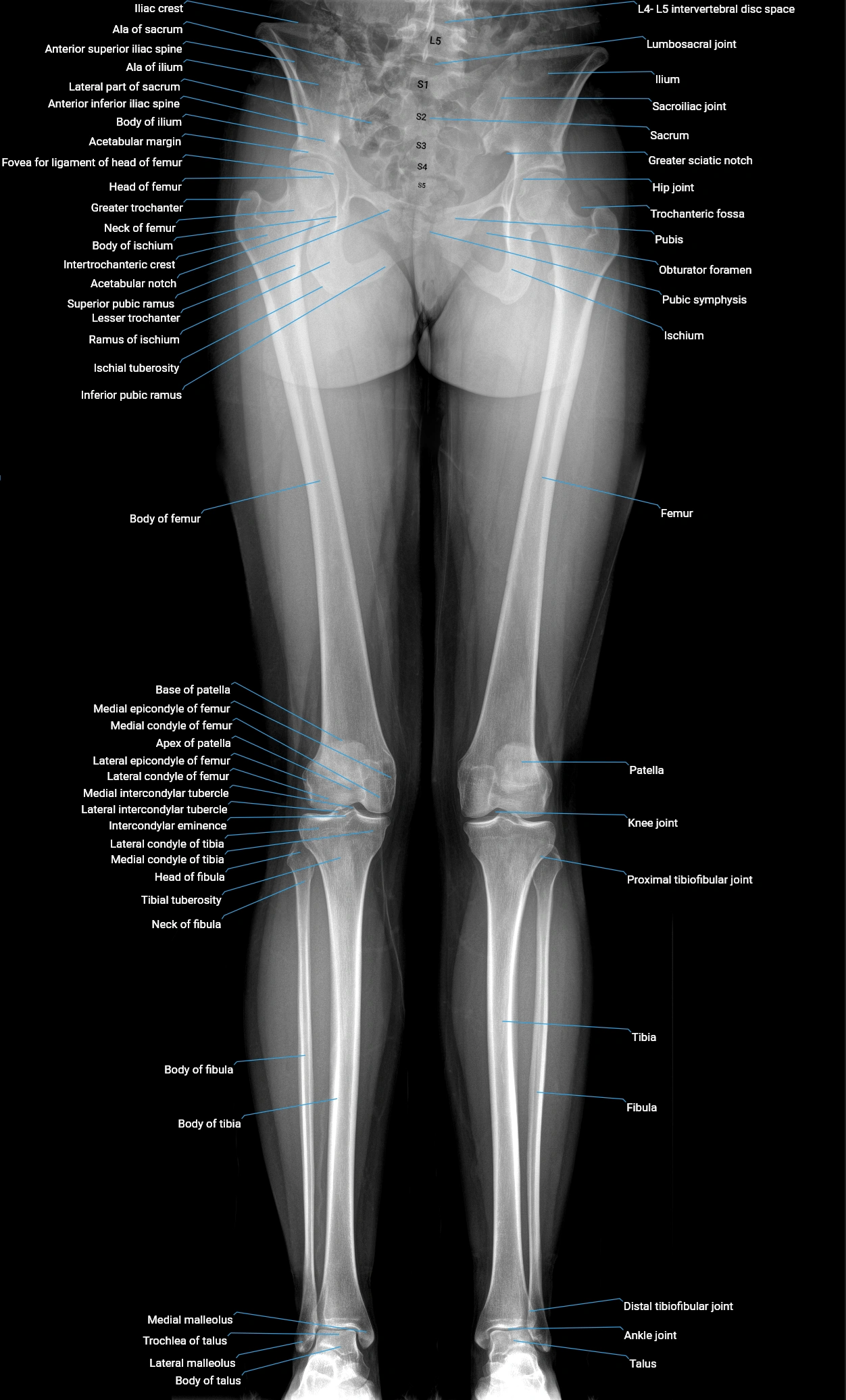 Lower limb X_rays anatomy labelled.webp